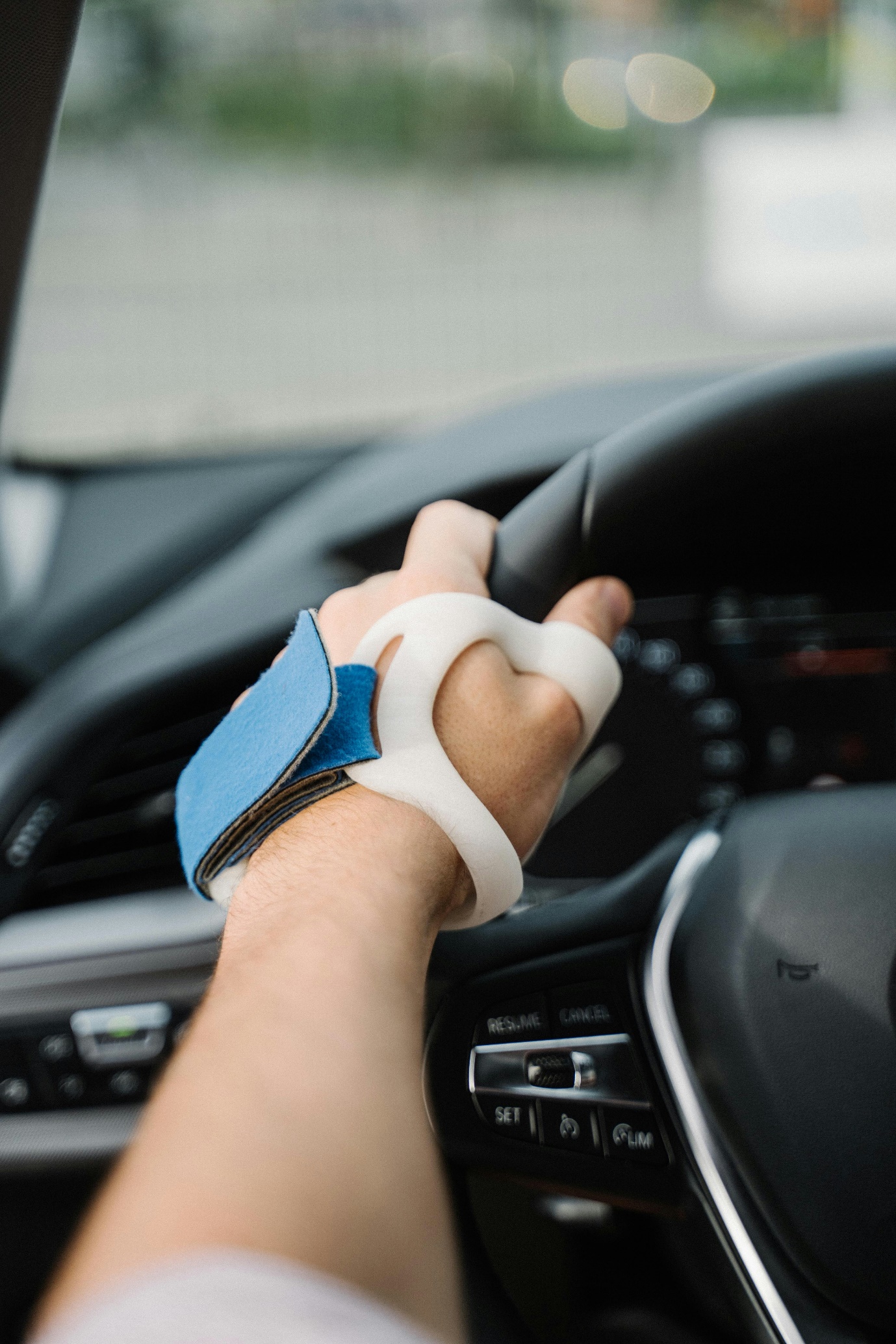 3D printed custom orthoses used in daily life